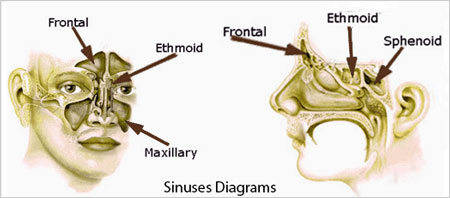sinusitis nasal-cleansing benefits